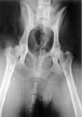 Pelvic x-ray with improper positioning of the patient